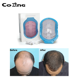 Home Care 650nm Low level Laser Therapy Hair Lose Laser Cap Hair Growth Helmet