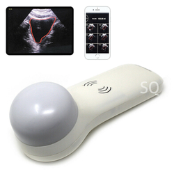 Portable Bladder Probe Scanner from ANIMUS CORPORATION LIMITED