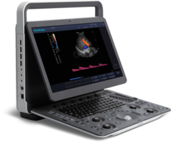 Color Doppler Ultrasound System