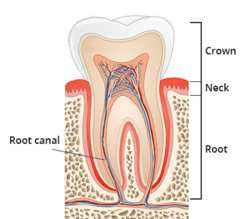 Root Canal Procedure from FAMILY COSMETIC & IMPLANT DENTISTRY OF BROOKLYN