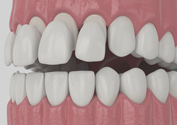 Dental Veneers Stamford, CT from STAMFORD DENTAL ARTS