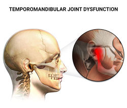 TMJ Treatment from PRECISION DENTAL NYC