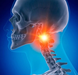 Neck Pain Treatment from NEW YORK PAIN CARE (NEW CITY)