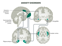 Anxiety Disorder Treatment NYC from ONLINE PSYCHIATRISTS