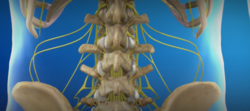 Complex Spinal Reconstruction in New Jersey from PREMIER BRAIN & SPINE UNION