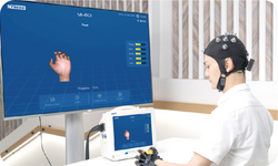 BCI- Brain-Computer Interface-Based Soft Robotic Glove Rehabilitation for Stroke