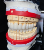 China Dental Laboratory - China Digital Dental Lab